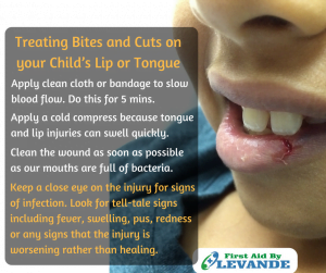 Treating Cuts on your Child's Lips